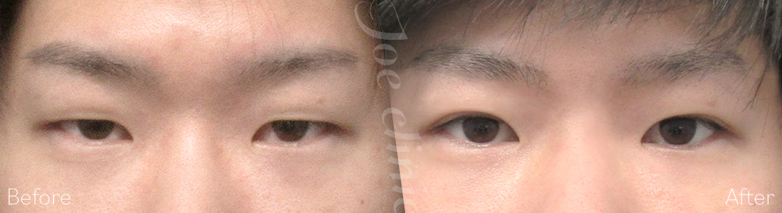 目もと症例
